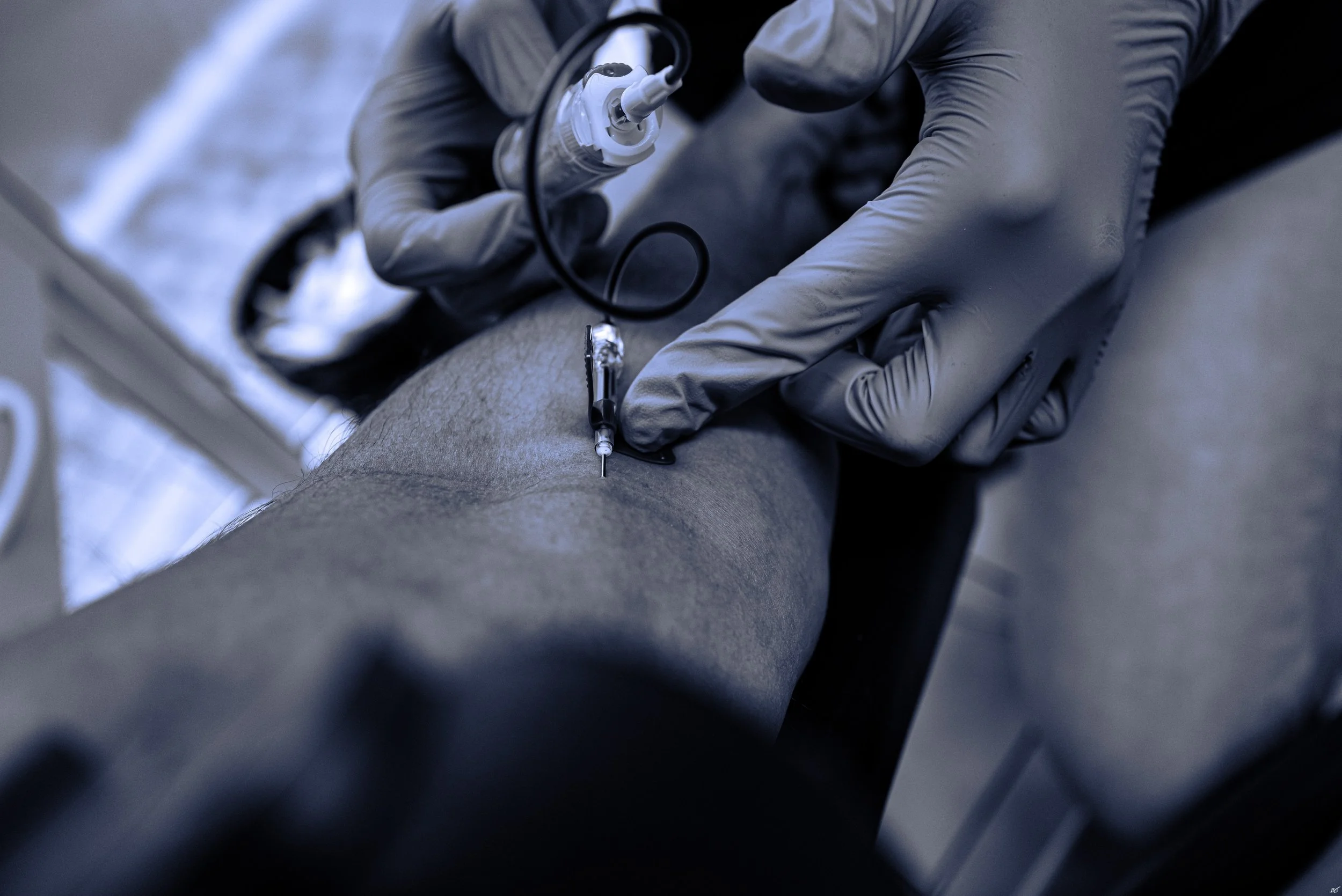 Resilience diary - pain today: 6/10. Photo: "&ETH;&egrave;şpėř&aacute;ṯẽ" 

I last saw the orthopaedic surgeon that took over my original doctor when i was fifteen and from then on i was on a mission to minimise the impact of my body on my 