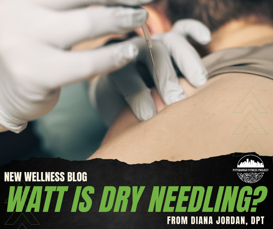 BLOG GRAPHIC: WATT IS DRY NEEDLING? Image of needle treatment.
