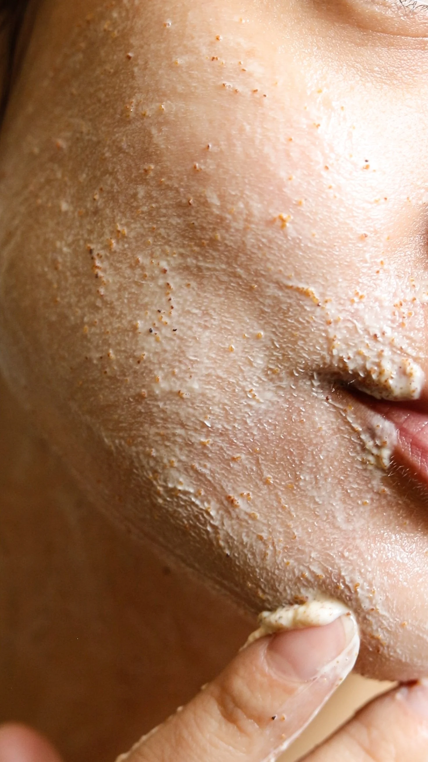 Close-up of a facial mask being applied in dots for a client skincare tutorial.