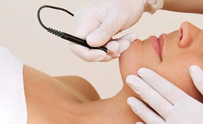 Electrolysis