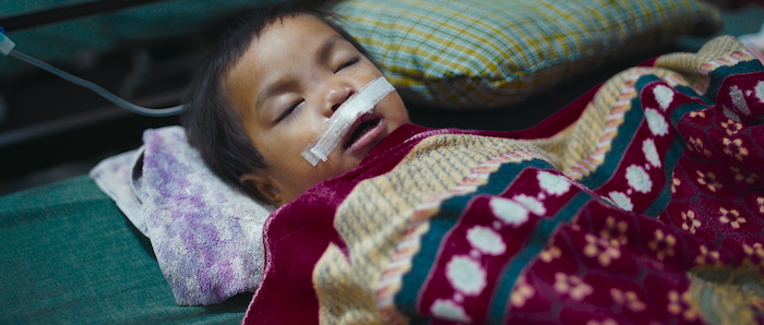 A young Filipino child rests after surgery at a Philippine hospital