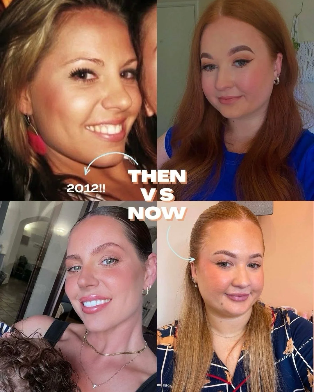 Even the best in the biz suffered through a bad brow era (what doesn&rsquo;t kill you makes you stronger I guess 😫)

We&rsquo;re sharing our most vulnerable sides to show you that there&rsquo;s no bad brow that can&rsquo;t be revived&hellip; you jus
