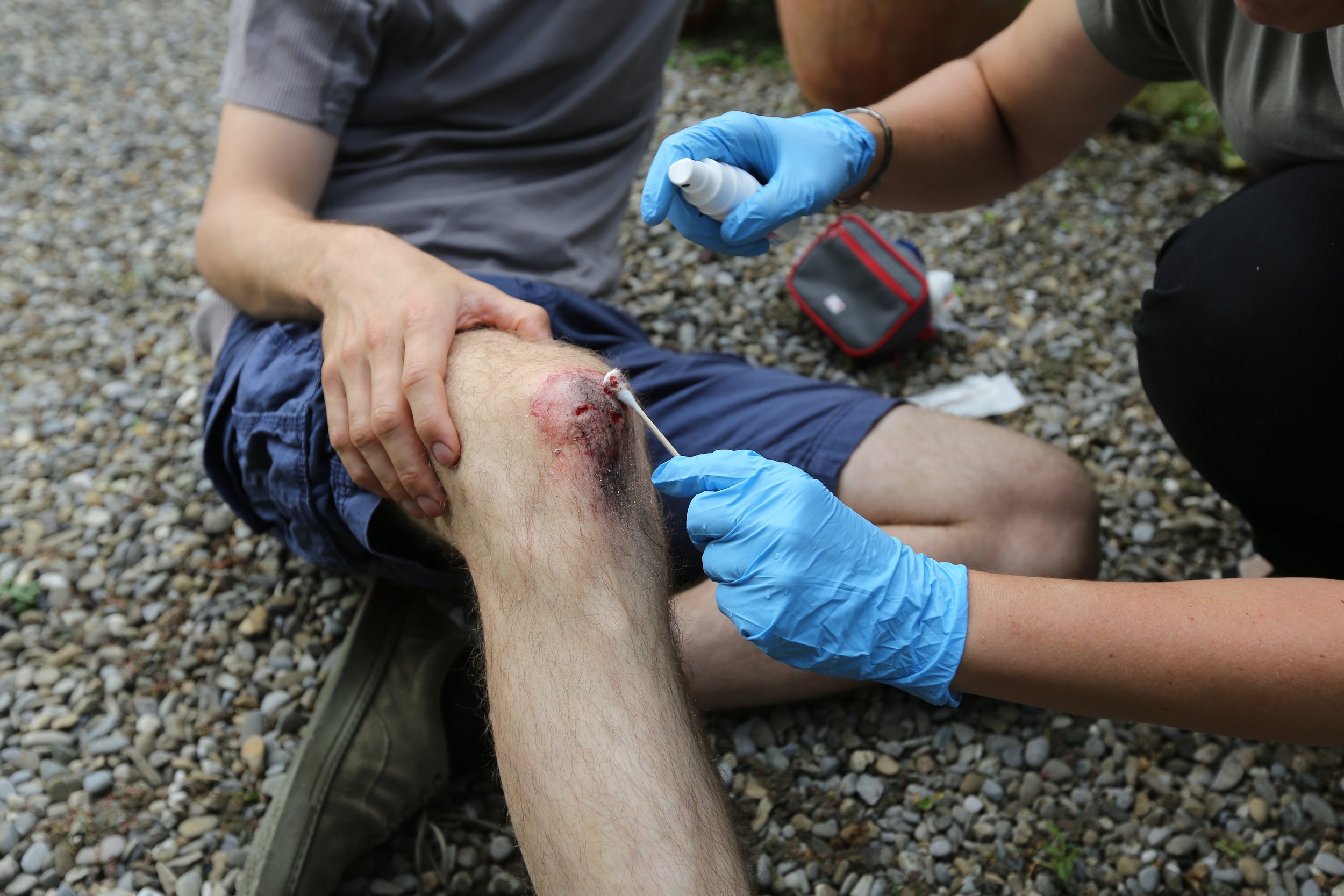 Personen versorgen eine Knieverletzung im Freien, eine Person hält das verletzte Bein, während die andere einen Verband anlegt.