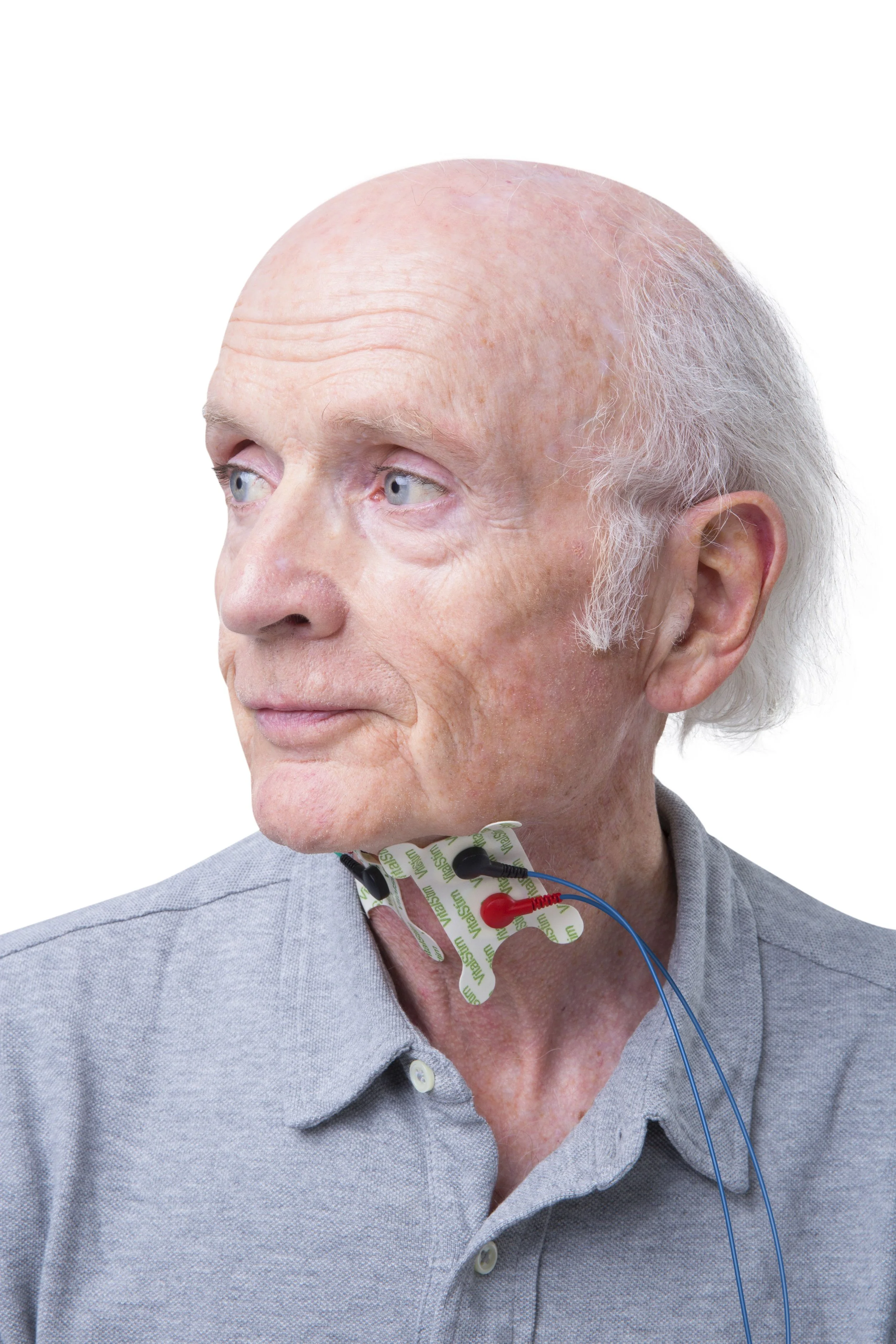 Electrode placement.jpg