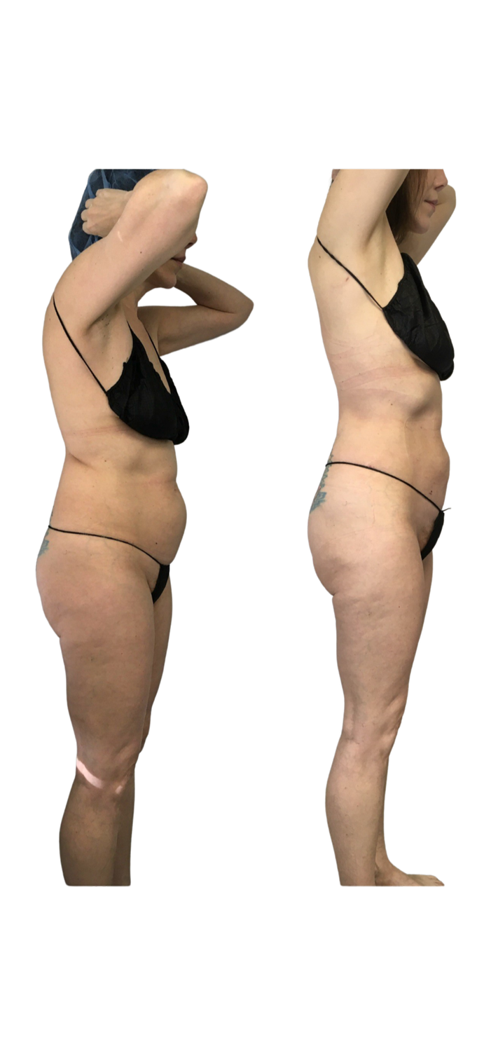 Copy of kimberly side view.png