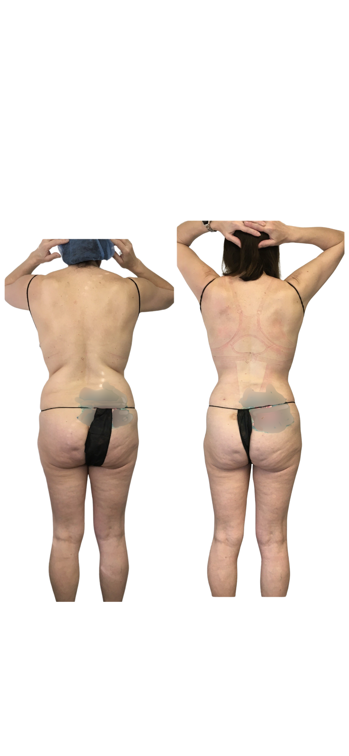 back side by side KS.png