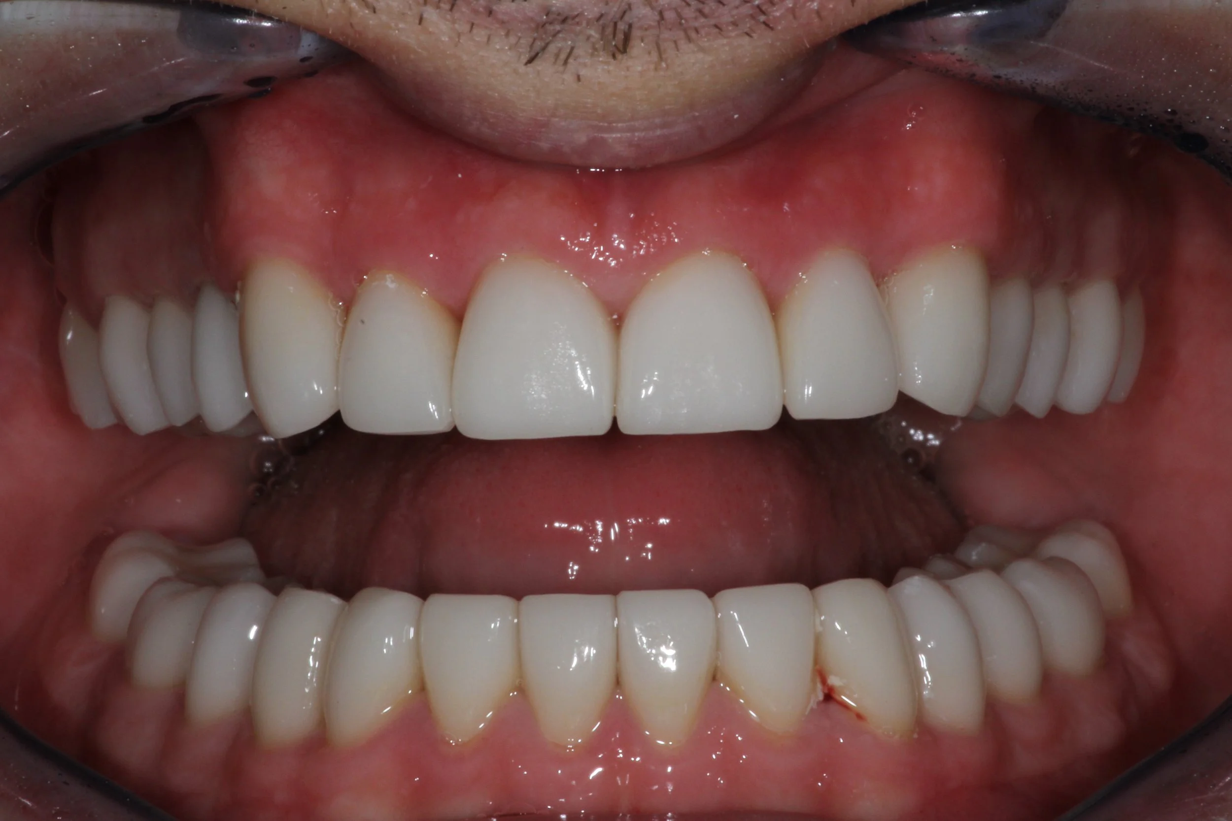 After