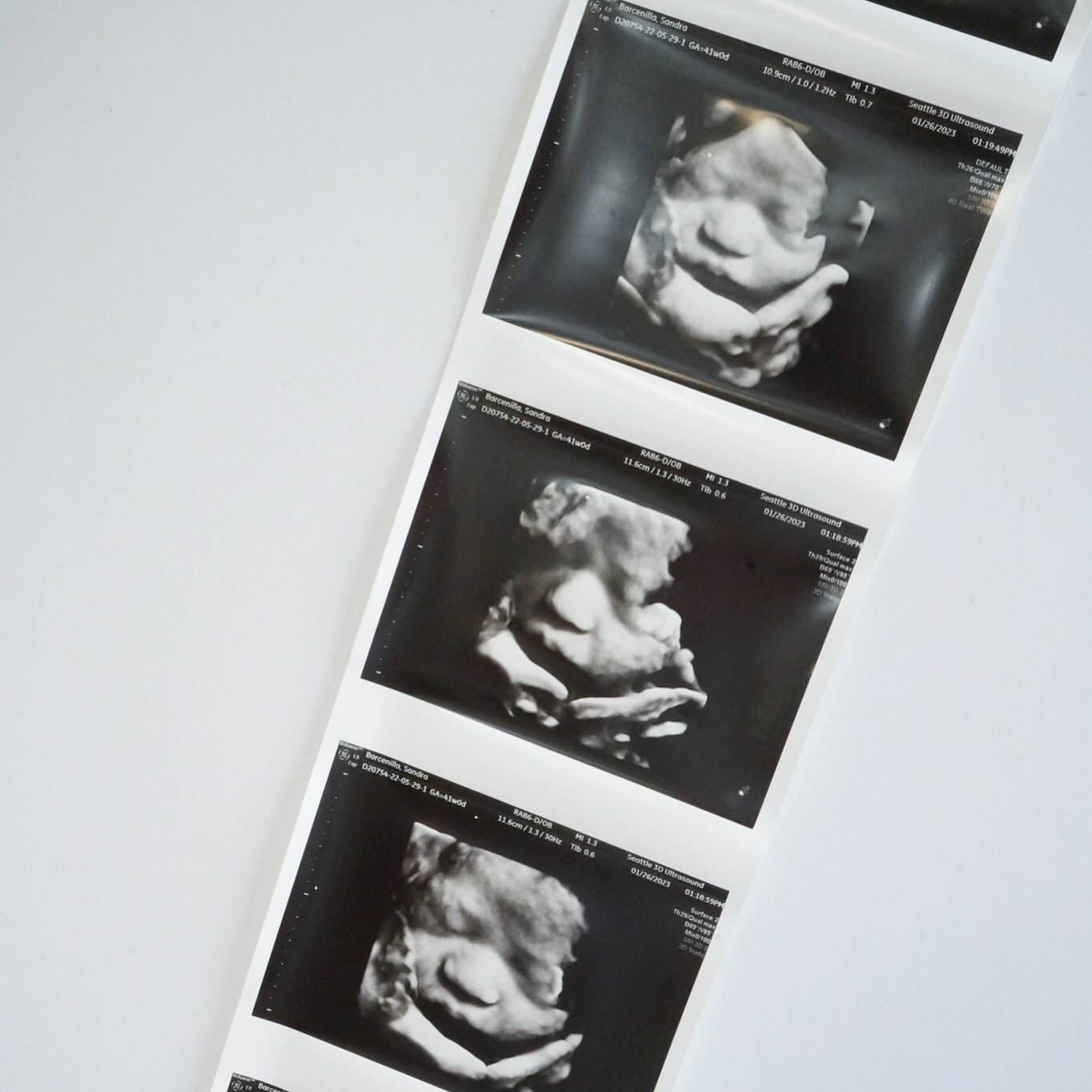 🌟 Expecting moms, experience the magic of seeing your baby in stunning 3D! At Seattle 3D Ultrasound, we bring you closer to your little one with incredible clarity and detail. This experience offers peace of mind and a unique connection with your ba