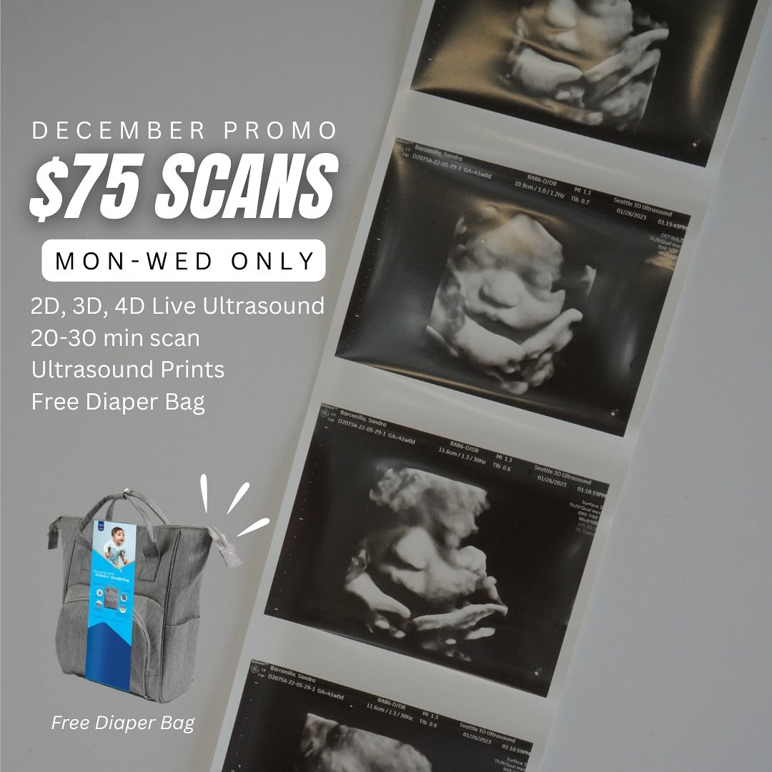Ring in the holiday season with some sneak peeks of baby&rsquo;s face, connect with your baby or even see your baby for a peace of mind this December! We can&rsquo;t wait to celebrate with you! 

Family &amp; friends are encouraged to join! 

Click t