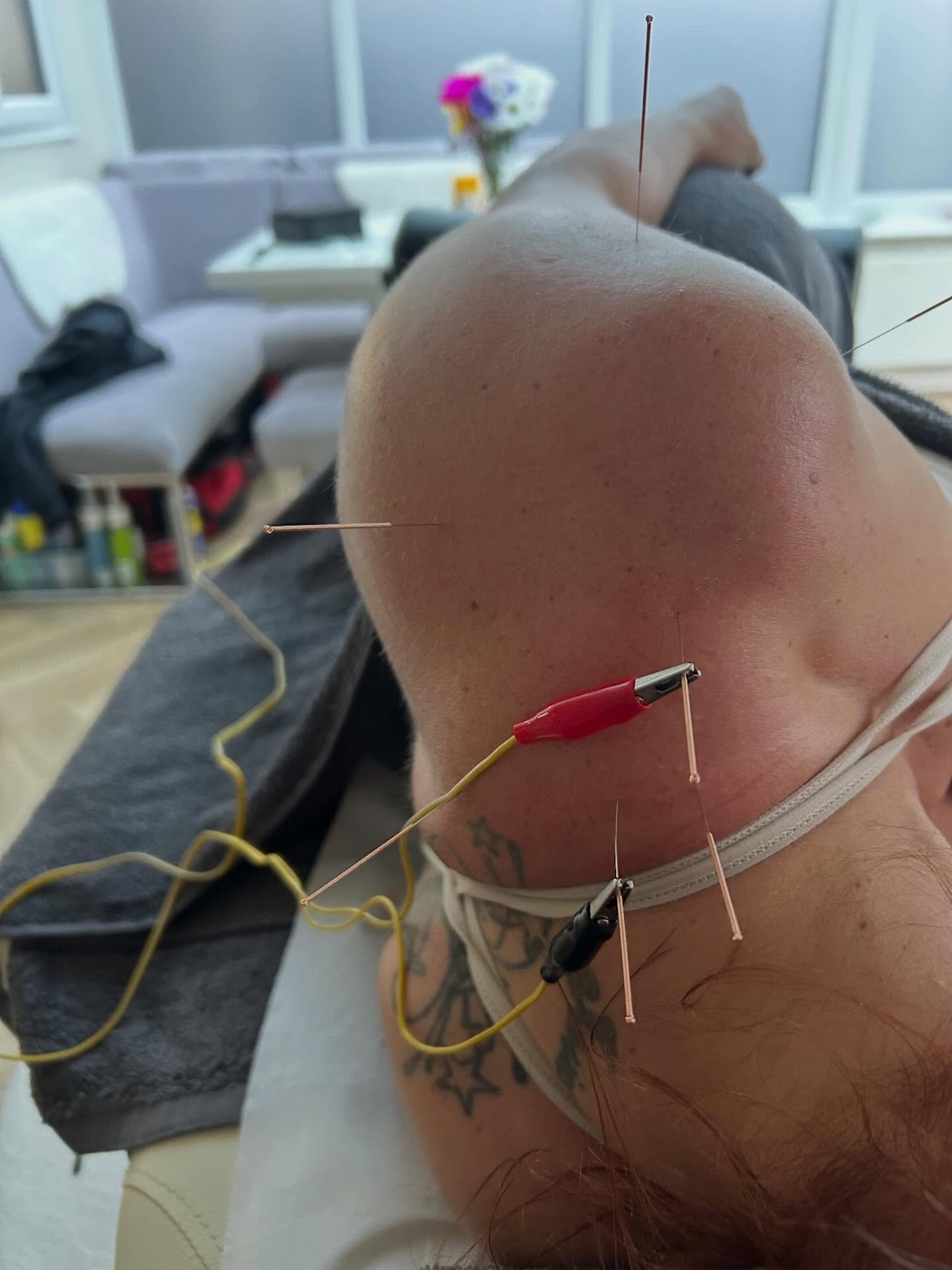 Had Cara in this morning to help sort her shoulder pain. 

She had limited internal rotation causing pain in some movements. I massaged and did some MET stretches to train the shoulder to be comfortable in stretched positions finishing off with elect