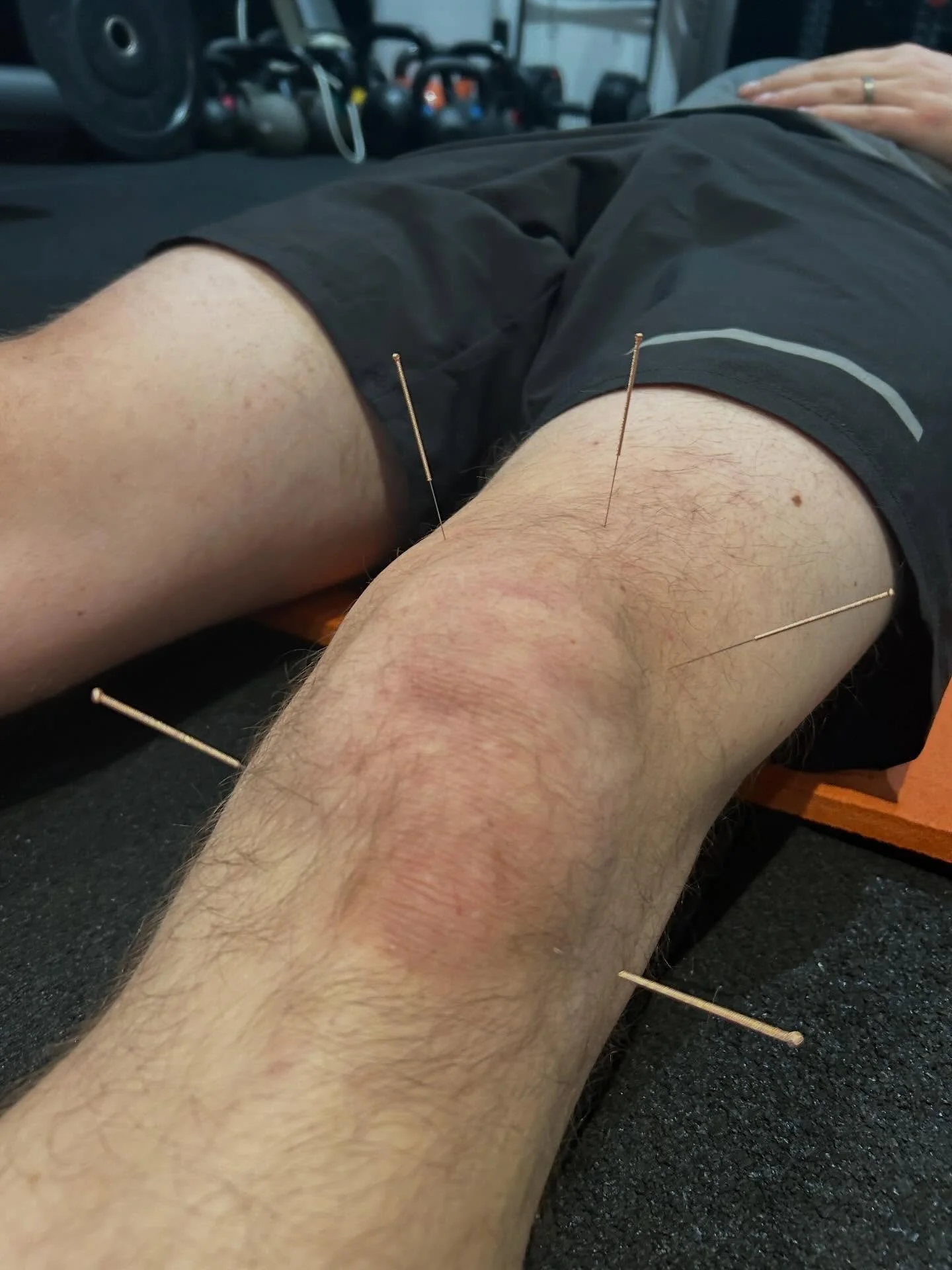 ❗️now taking bookings for May ❗️

If you are suffering with an injury that&rsquo;s affecting your training or even your every day life 

Or 

If you are looking to ease tension in your muscles then now&rsquo;s the time to get yourself booked in for M