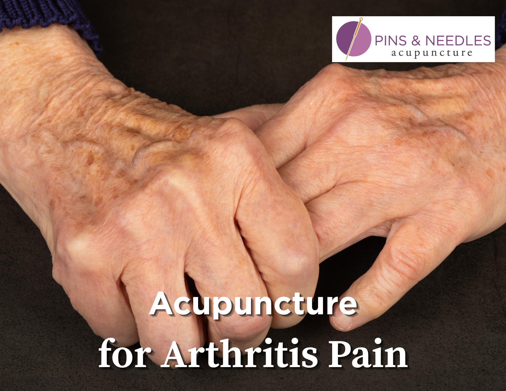 Acupuncture for Arthritis Pain: Gentle Relief for Stiff, Achy Joints