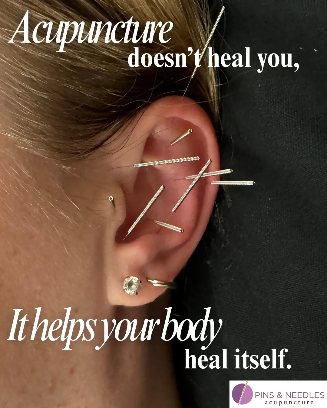 Let us support your body in healing itself! ✨