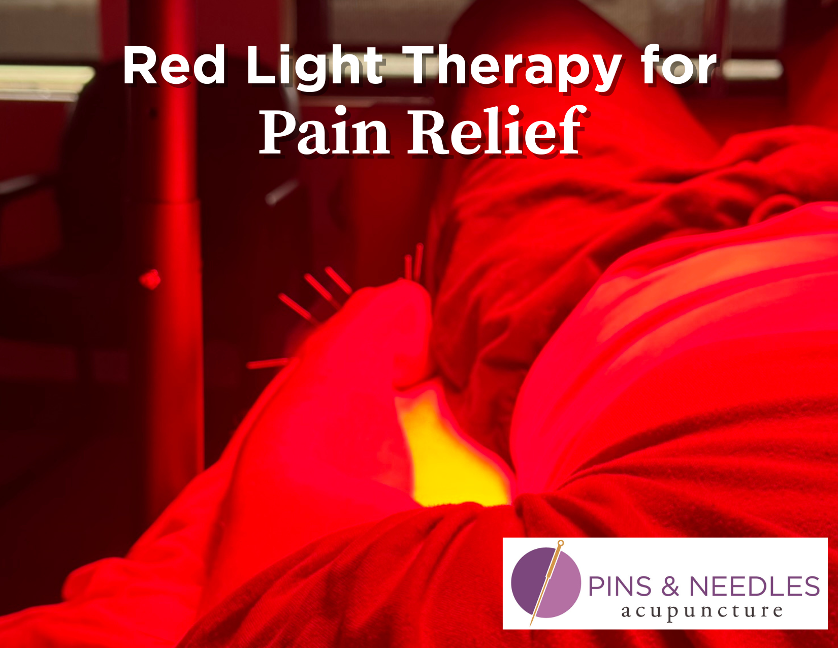 Red light therapy for pain relief with acupuncture