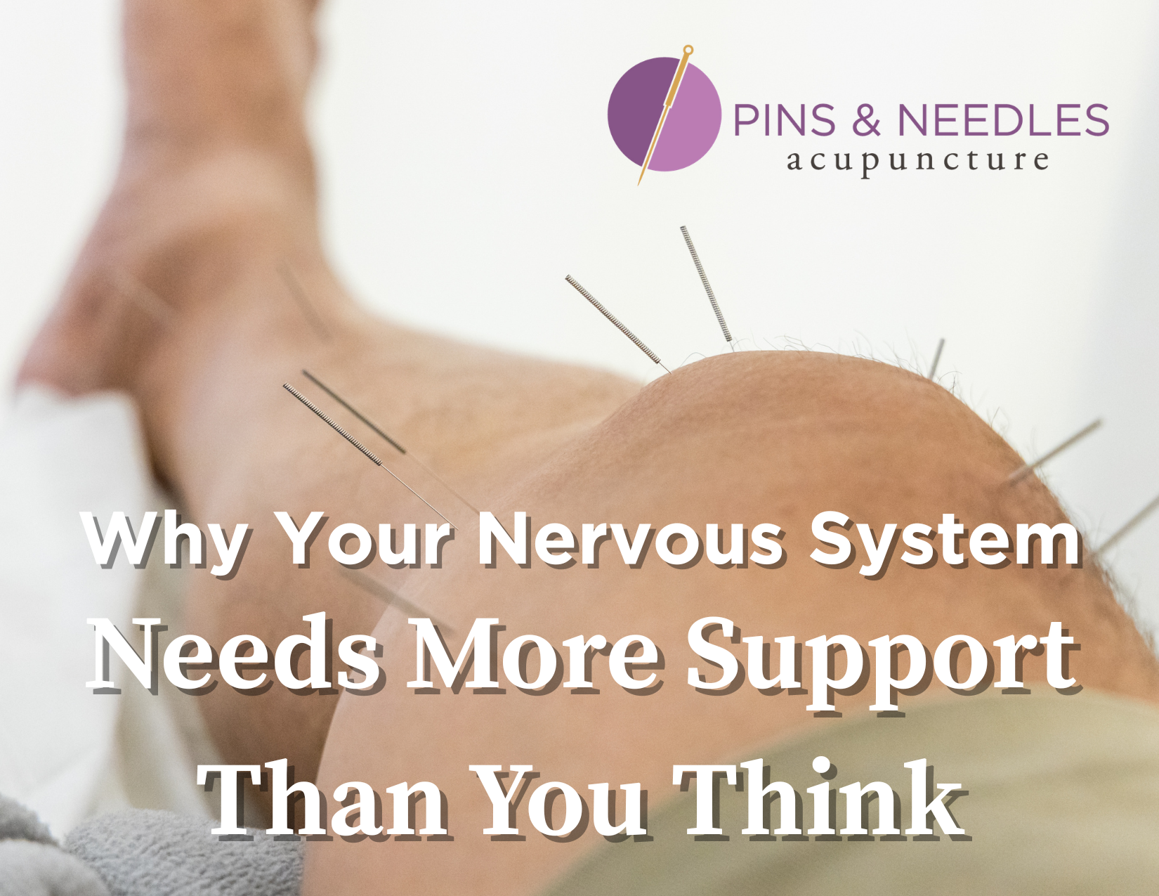 A knee with acupuncture needles