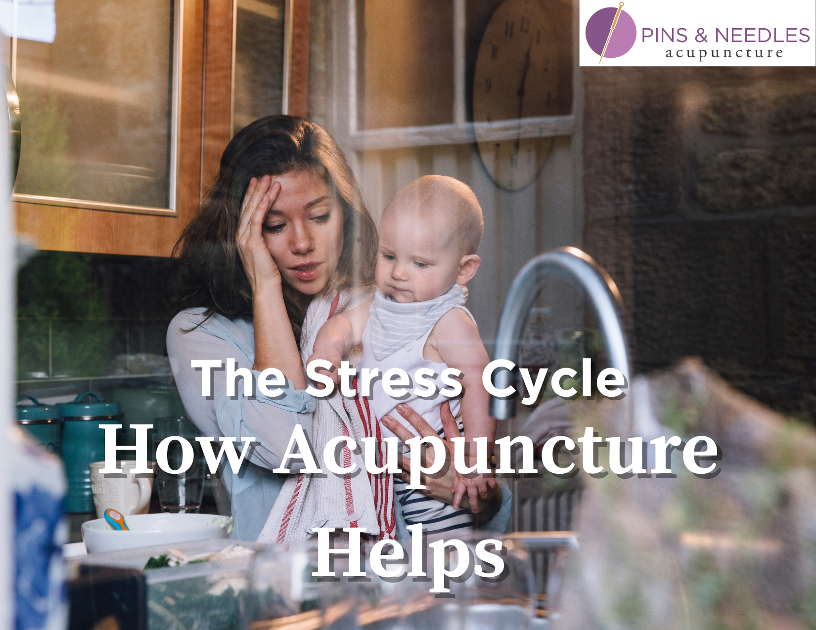 How acupuncture can help with stress