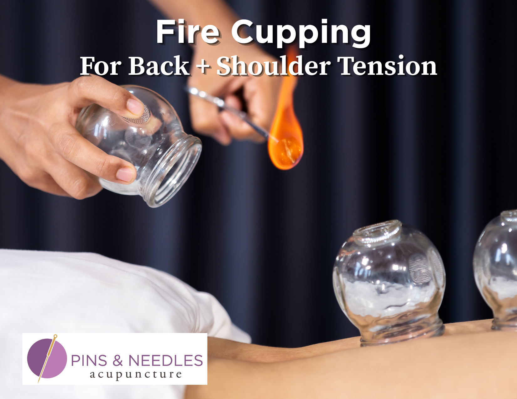 fire cupping on someone's back