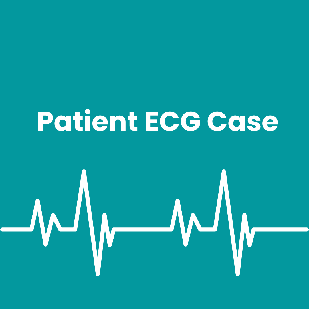 ECG Case: Posterior STEMI