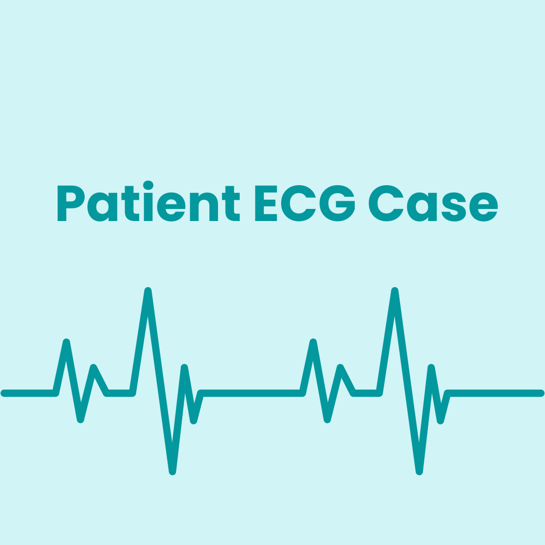 An Interesting ECG Case