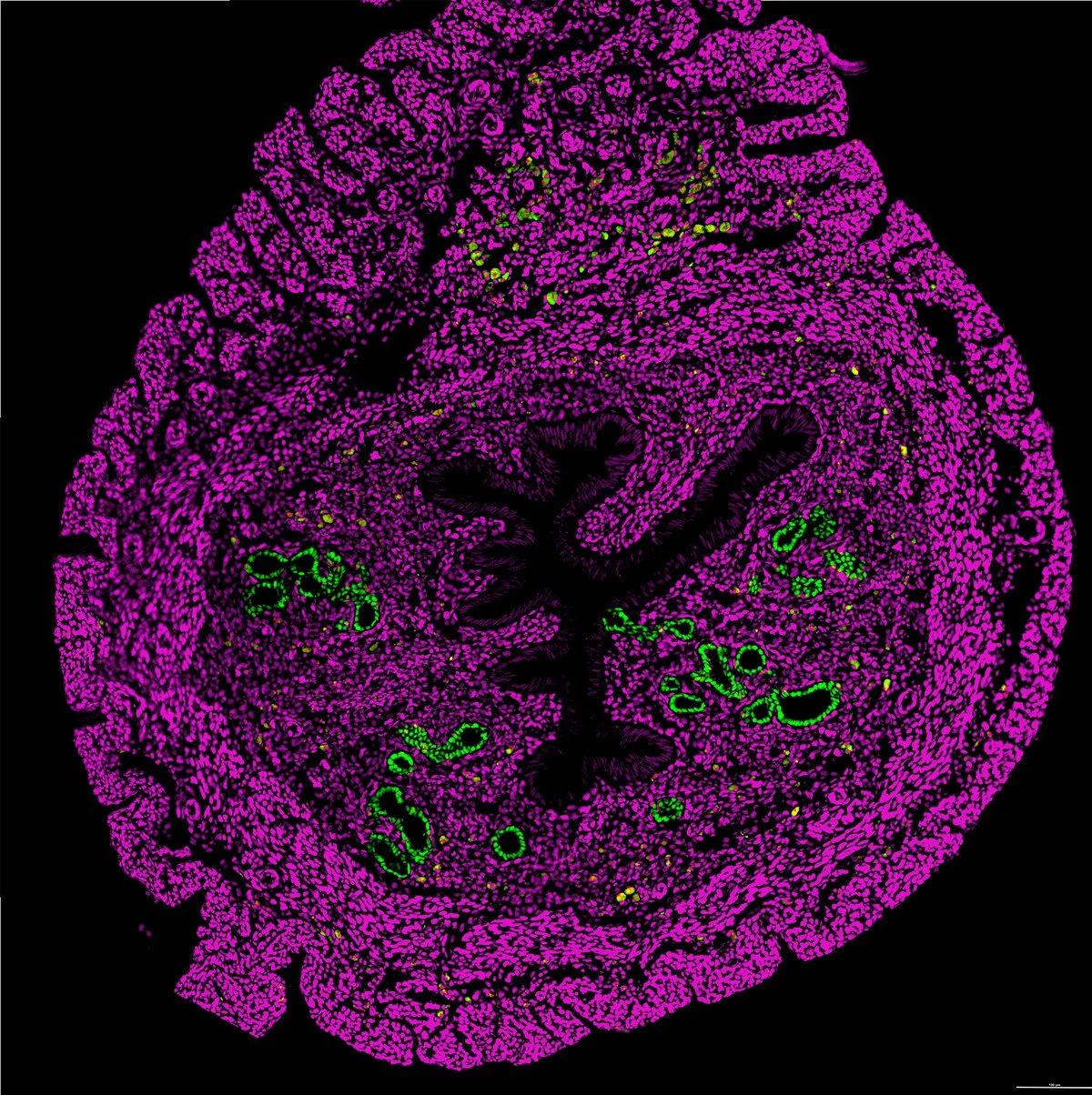 Adult uterine cross-section with lineage-traced glands (green) in stroma (magenta)