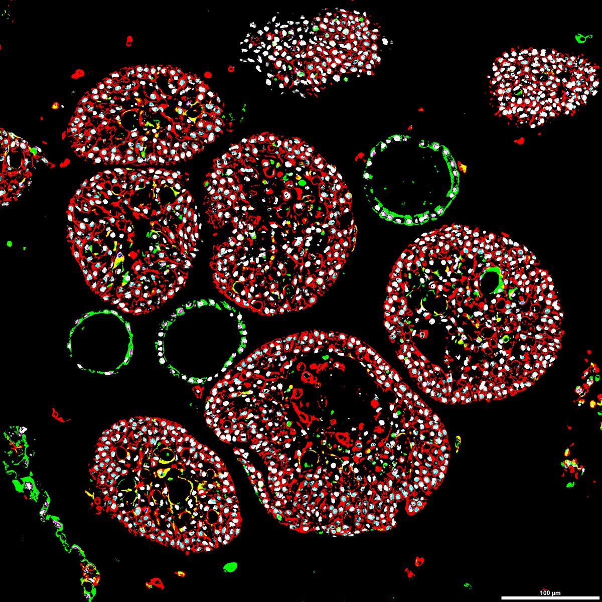 Neonatal uterine epithelial organoids