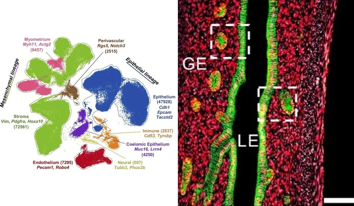 Single-cell UMAP of mouse uterine cell types beside a PND15 uterus stained for ESR1 (red) and CDH1 (green)