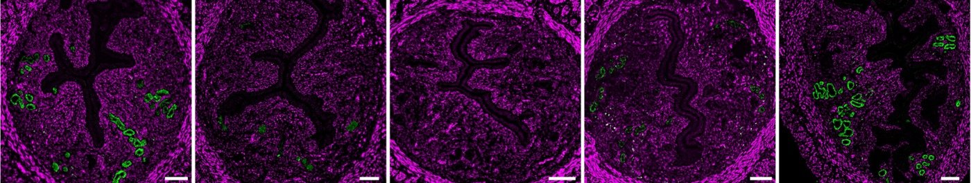 Five uterine cross-sections over ten days after glandular ablation: lineage-traced glands (green) are lost and regrow within stroma (magenta)