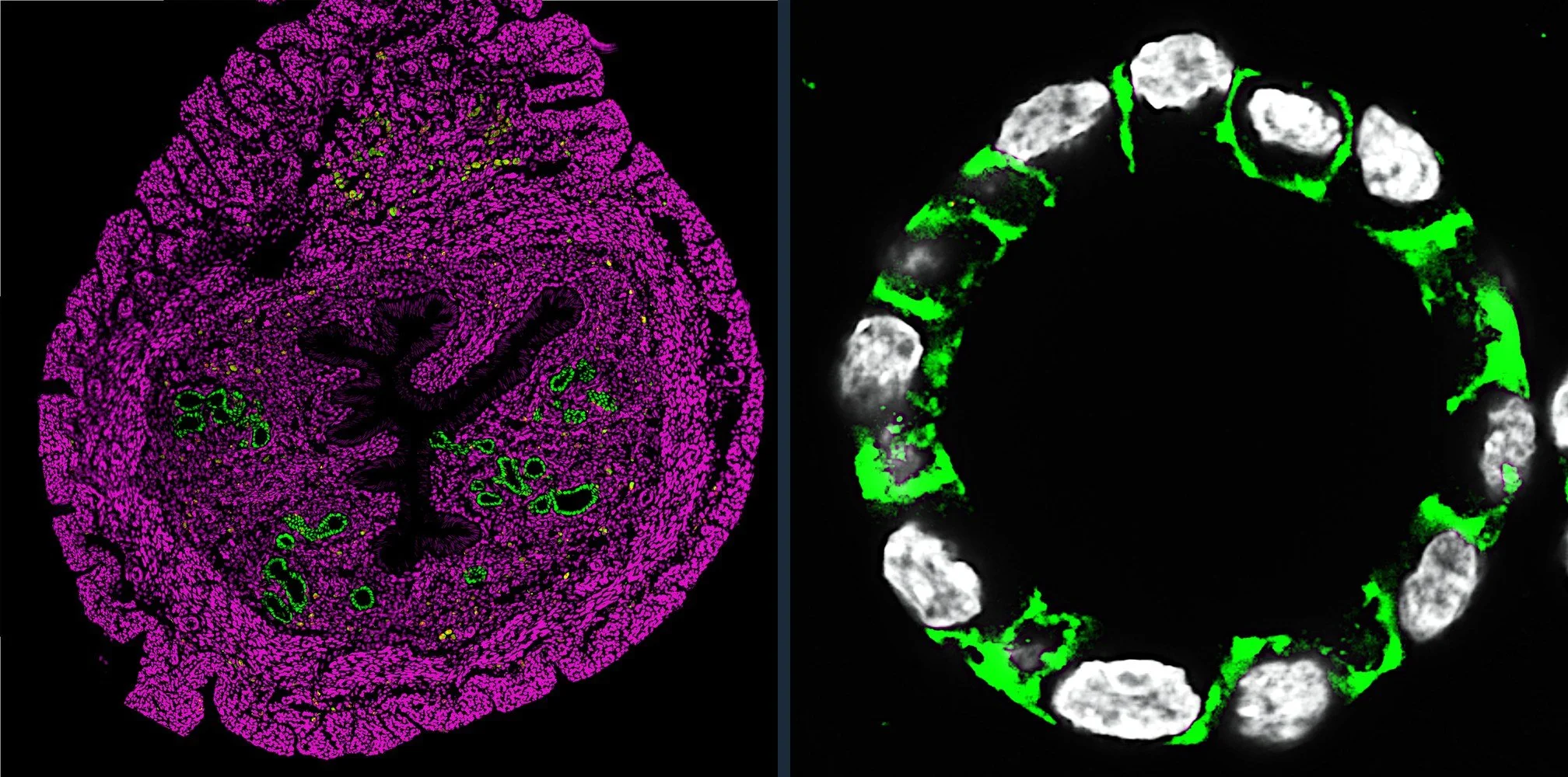 Cxcl15-Cre Rosa26 nT/nG mouse uterus beside an endometrial organoid stained for E-cadherin (green) and nuclei (white)