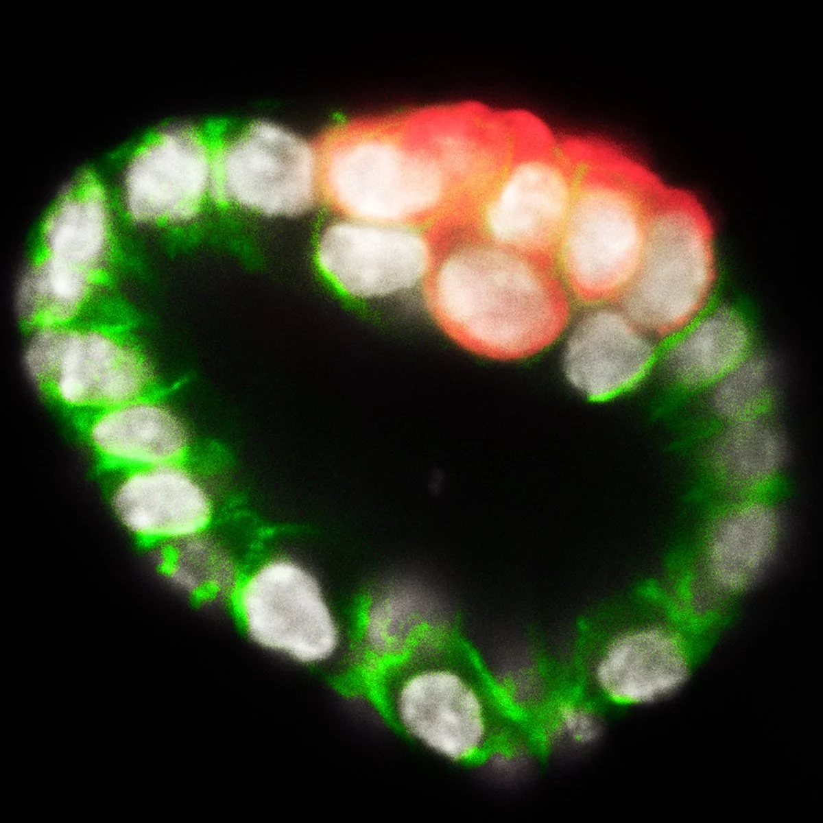 Confocal image of an endometrial organoid: epithelium (green) and nuclei