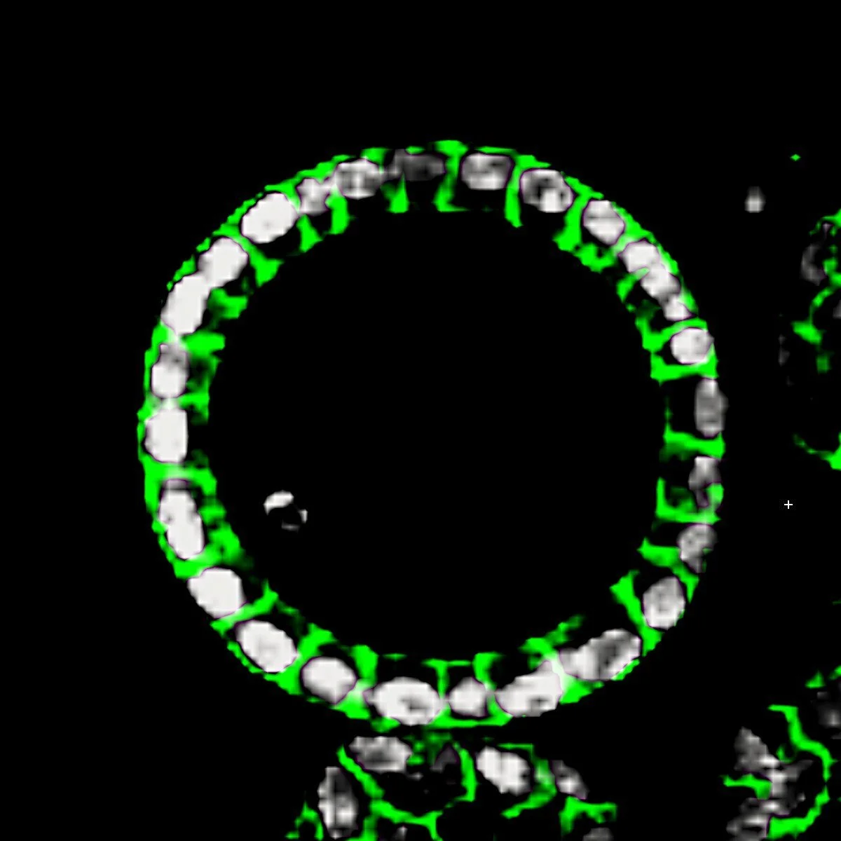 Uterine epithelial organoid: a single polarized layer of epithelial cells