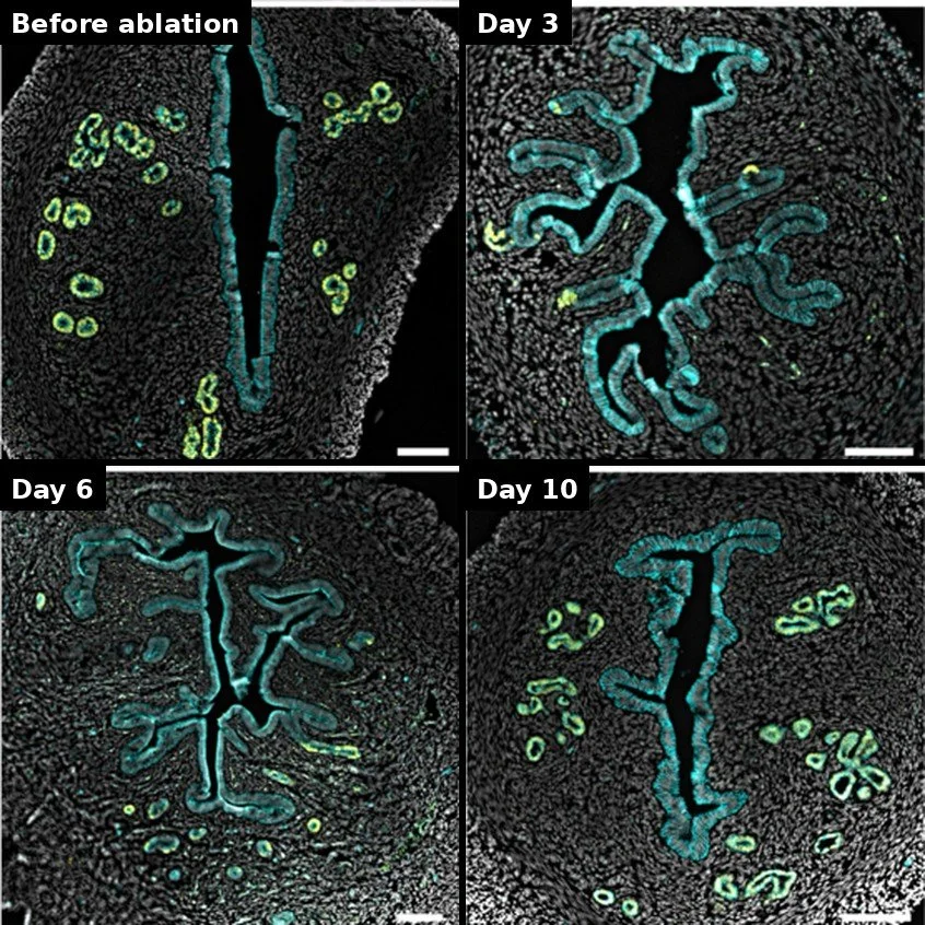 Time course of gland regeneration after ablation: CDH1 (cyan) and FOXA2 (yellow) before ablation and at days 3, 6 and 10