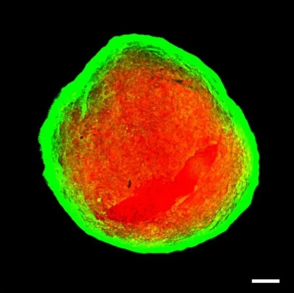 Mouse endometrial assembloid: organoid epithelium (green) wrapping a stromal core (red)