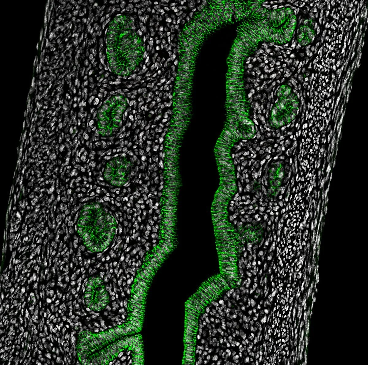 Neonatal mouse uterus: CDH1-positive epithelium with budding glands