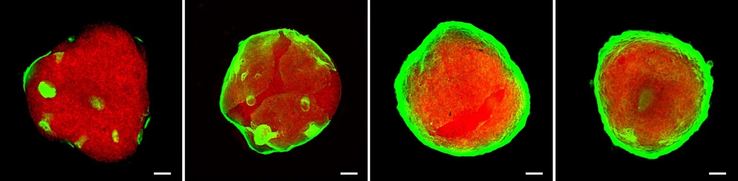 Mouse endometrial assembloids over four days: organoid epithelium (green) wraps a stromal core (red)