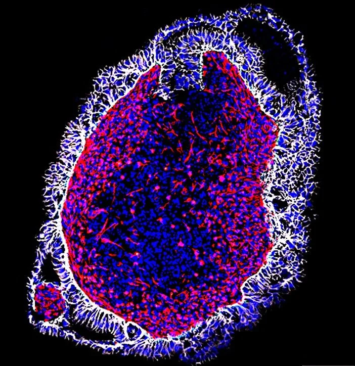 Endometrial assembloid: CDH1 (white), VIM (red), nuclei (blue)