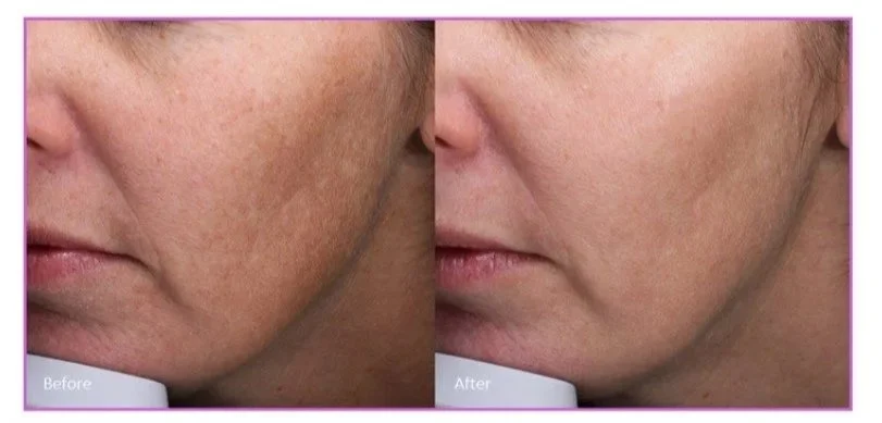 Moxi Mondays Are Here! Your Skin Just Got a Glow-Up