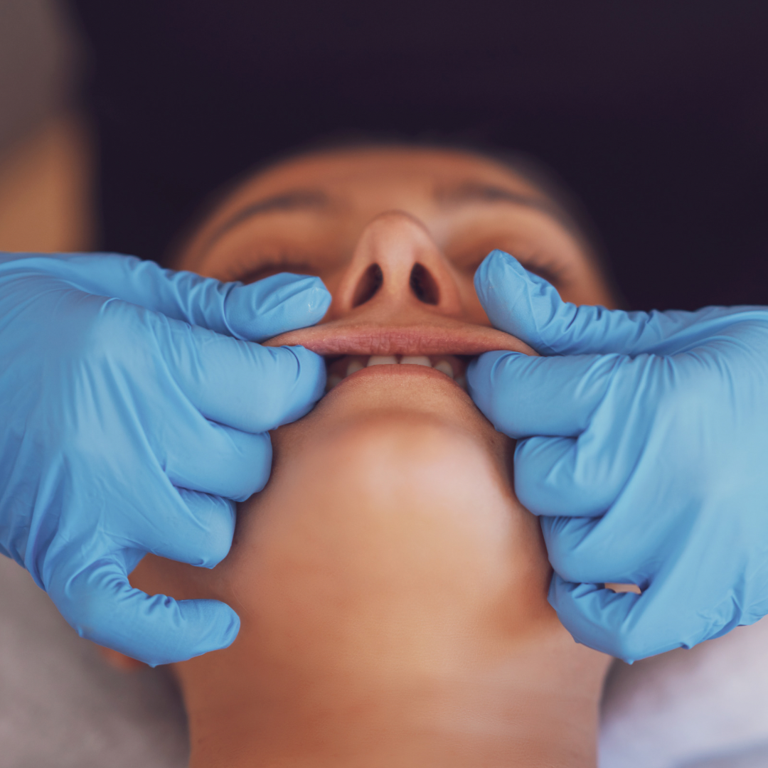 A woman getting her upper lip massageed at Topaz Facial Studio in Vancouver, BC