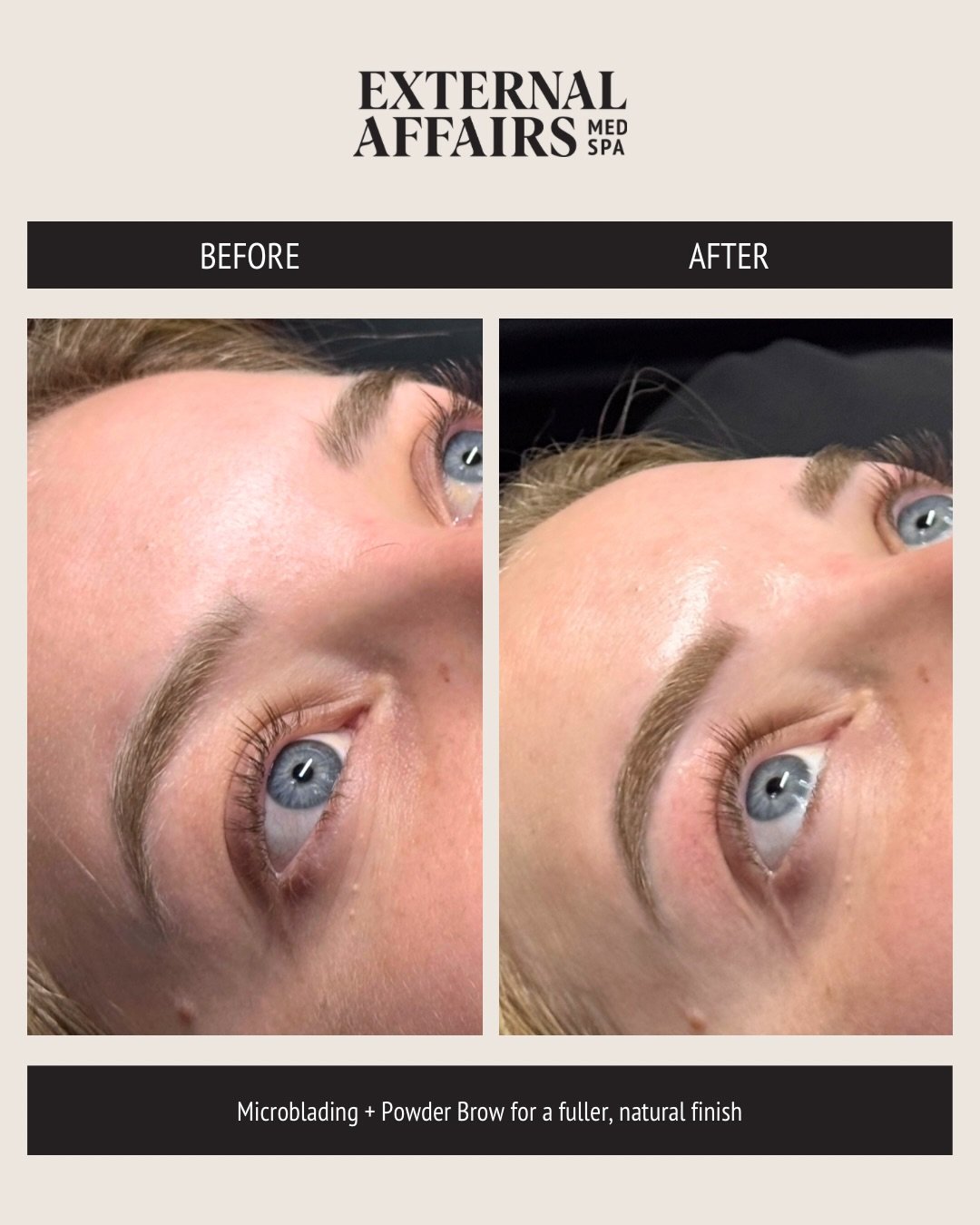 The kind of subtle enhancement that makes everything feel more put-together. 🤍

This combo brow result (microblading + powder shading) was designed to enhance shape, add fullness, and keep everything soft.

From structure to tone, every detail is ch