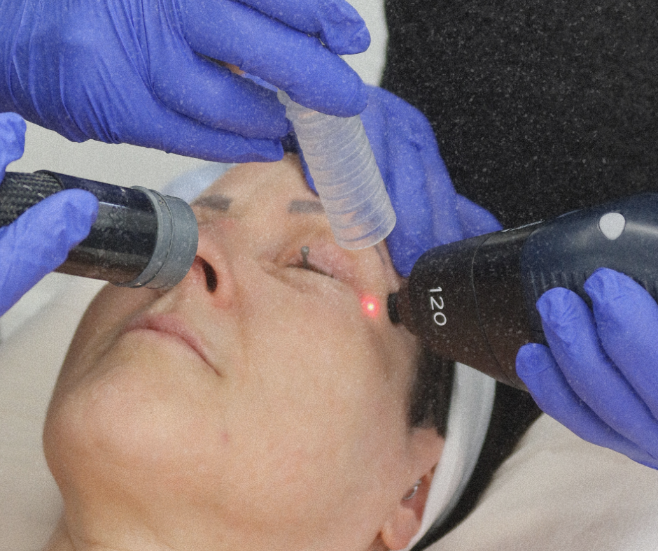 Making CO₂ Resurfacing Safe &amp; Comfortable for You