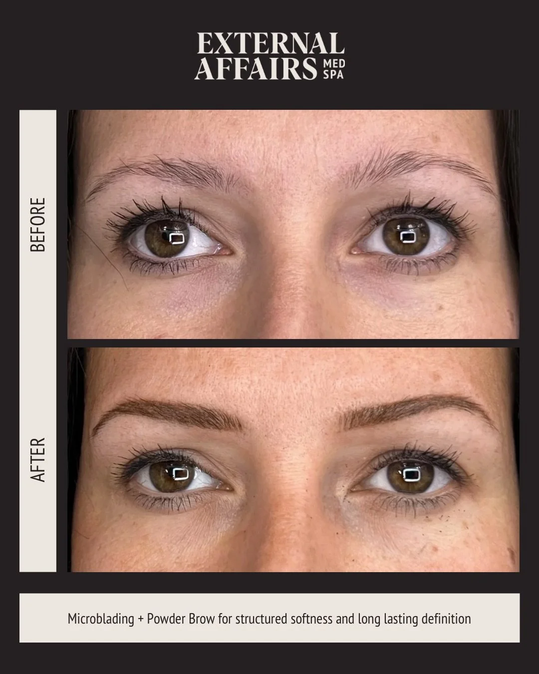 The power of a perfectly balanced combo brow ☺️

Microblading + Powder Brow for soft structure and added fullness. Realistic strokes in the front with gentle shading to build depth.

Freshly done and ready to heal beautifully. Book your appointment t