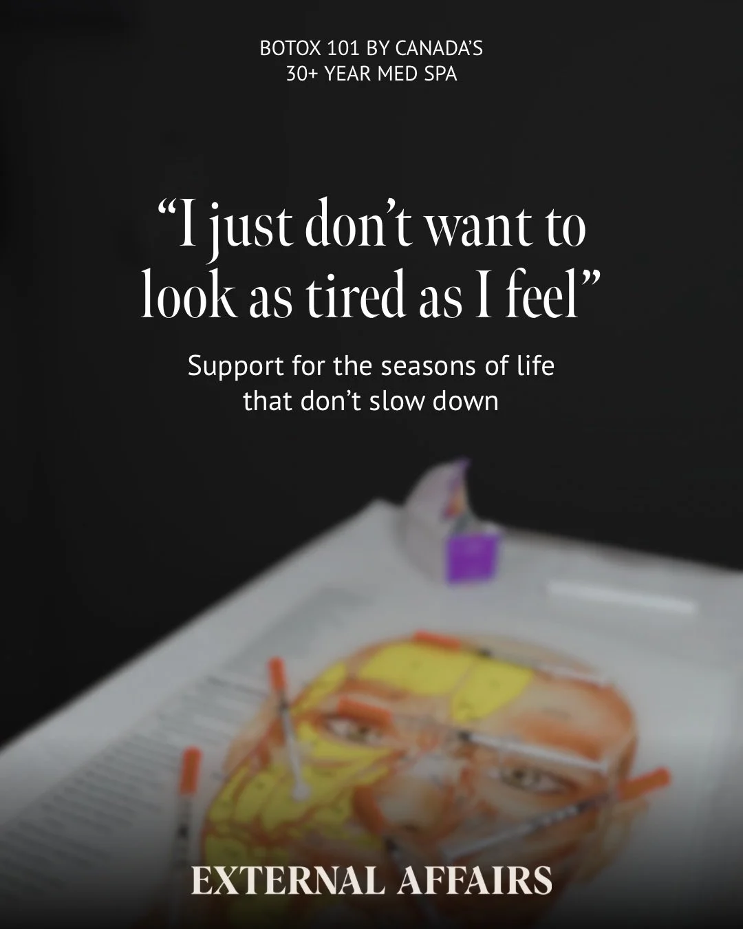 Subtle treatments for the seasons that ask the most of you. 

#botox #neuromodulators #injectables #yegmedspa #nurseinjector