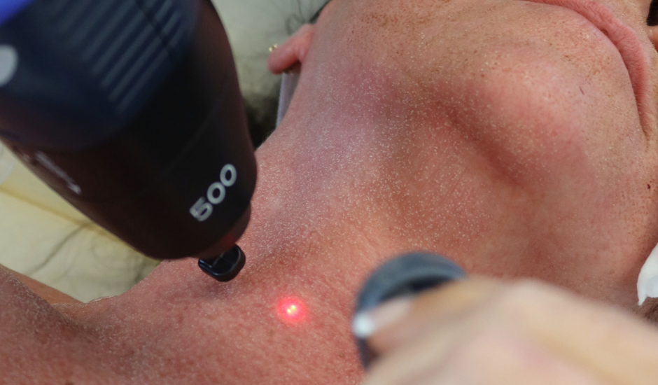 Lutronic eCO₂ laser treating the neck during fractional CO₂ laser resurfacing to stimulate collagen and improve skin texture.