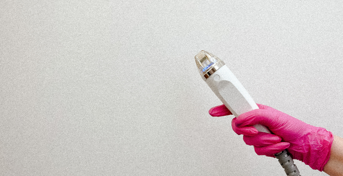 Secret™ RF Microneedling in Edmonton and St. Albert — External Affairs