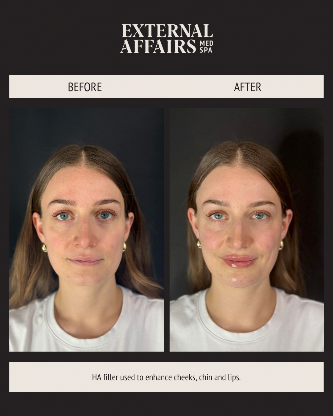 ST editing - VERTICAL - DARK BACKGROUND.PNG