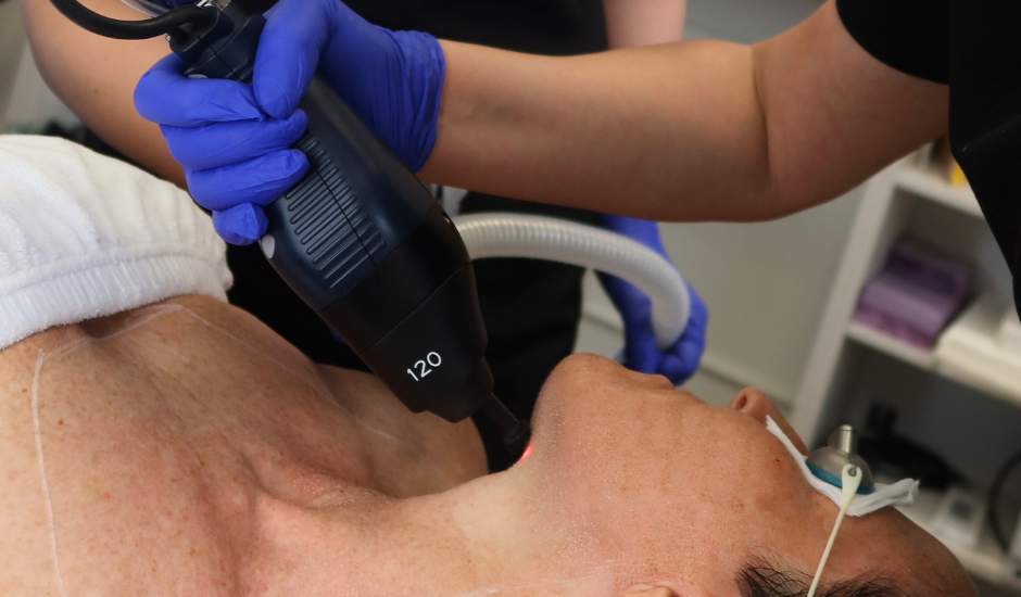 Lutronic eCO₂ laser 120 handpiece targeting the chin during fractional CO₂ skin resurfacing treatment.