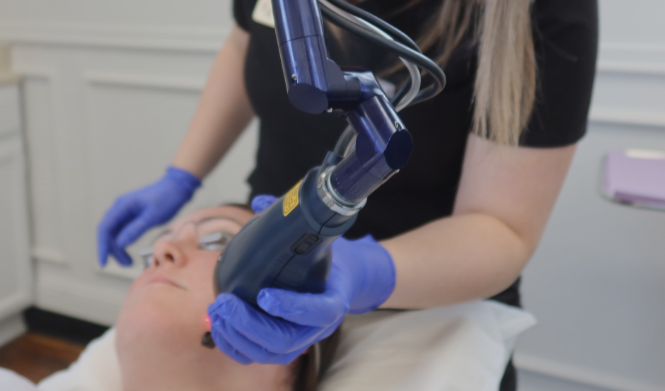 Medical professional performing CO₂ laser skin resurfacing treatment using Lutronic eCO₂ laser on a patient’s face at External Affairs Medical Spa