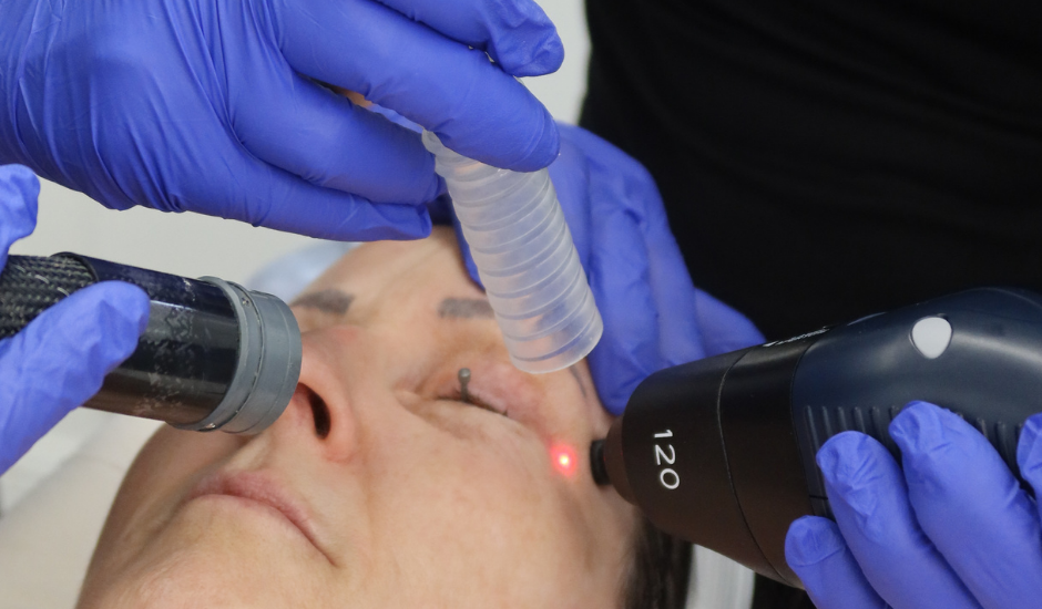 Lutronic eCO₂ fractional CO₂ laser resurfacing with integrated cooling and precision energy delivery for safe, controlled treatment.