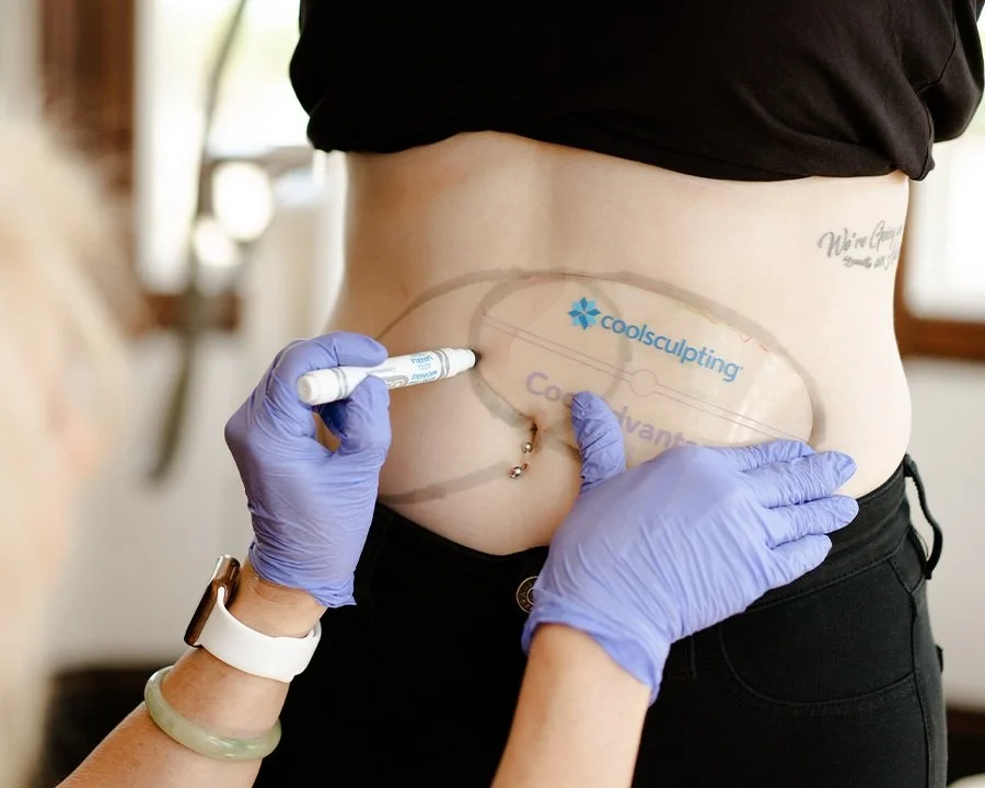 CoolSculpting®.jpg