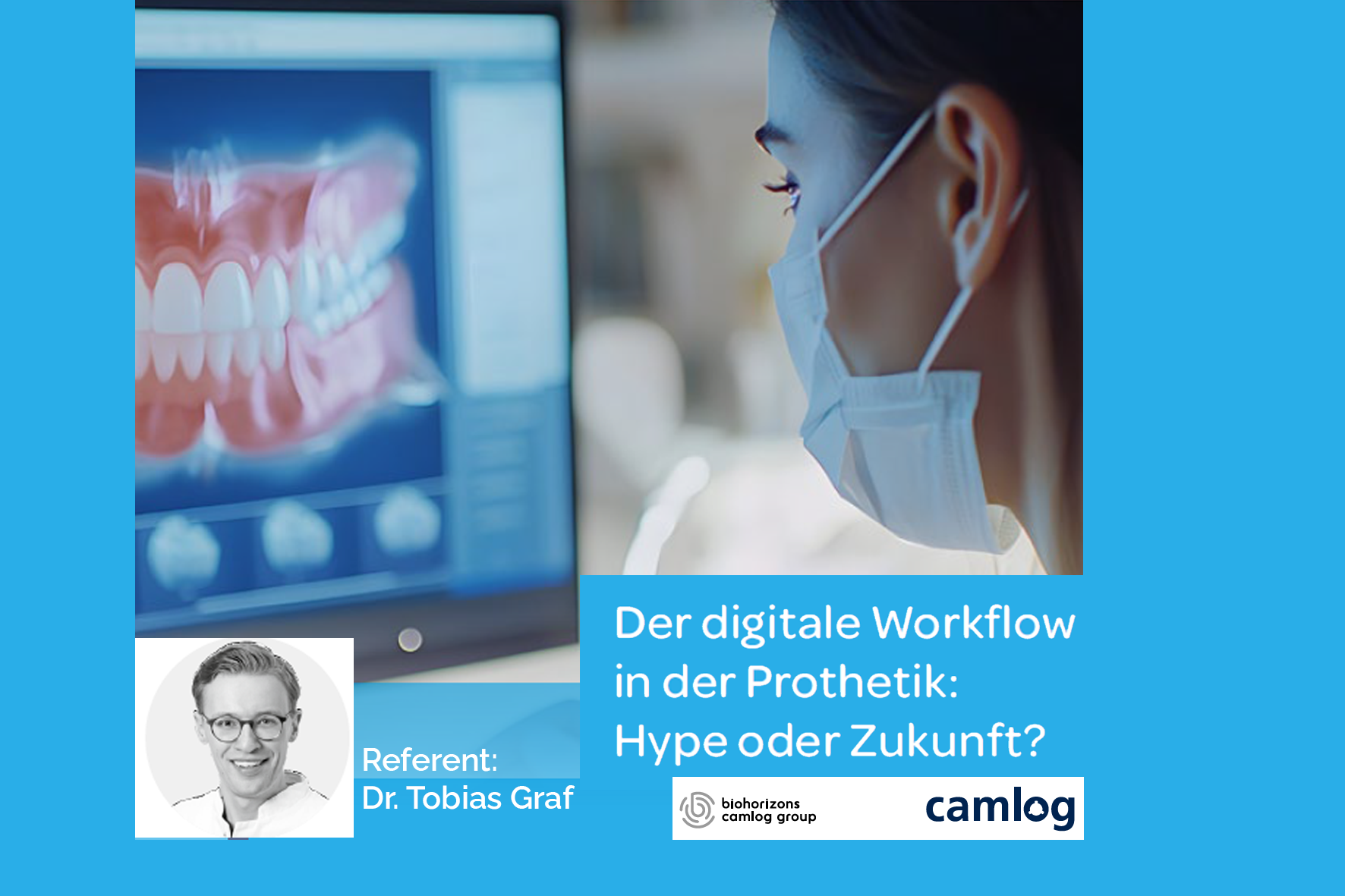 CAMLOG: Der digitale Workflow in der Prothetik: Hype oder Zukunft?