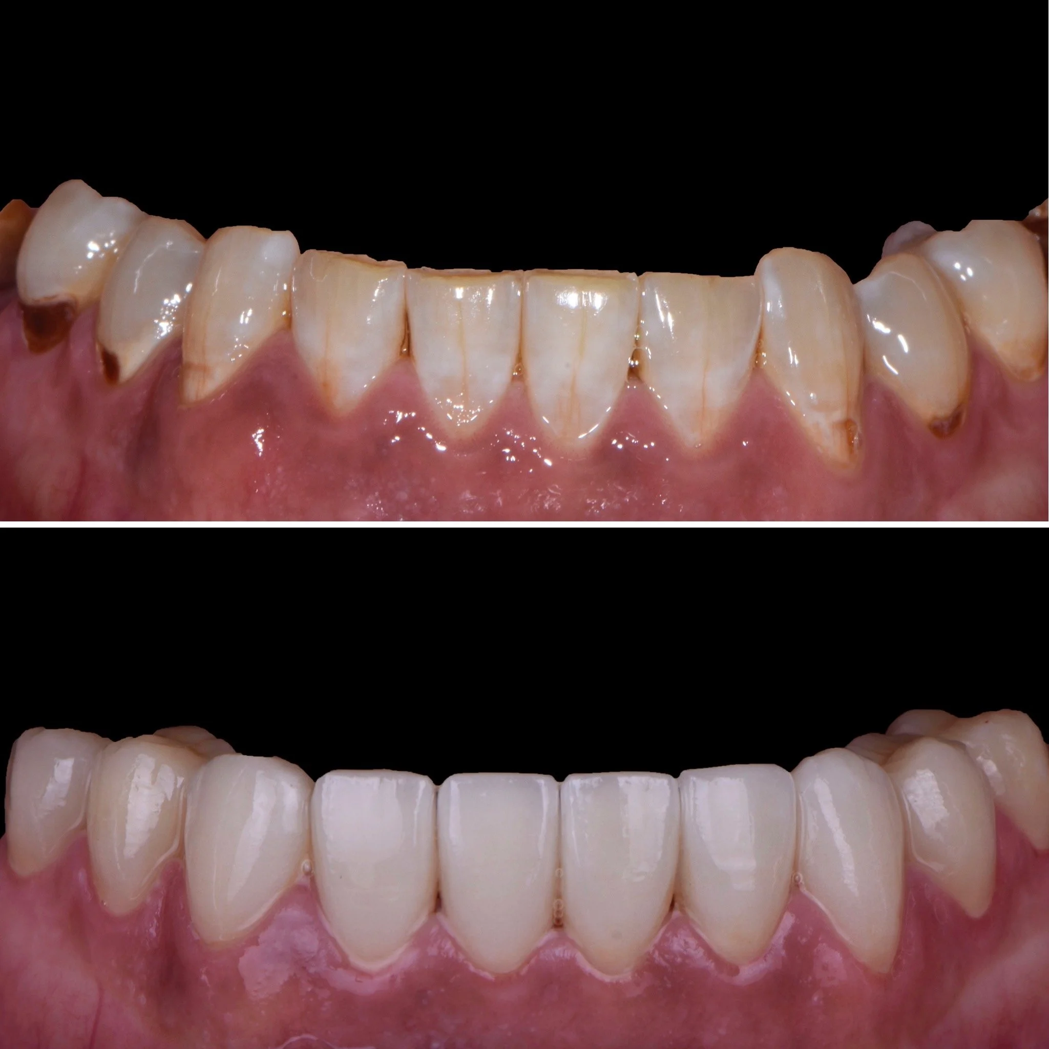 BD Before and After.JPG